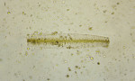 diatoms-fragilaria-sp.jpg
