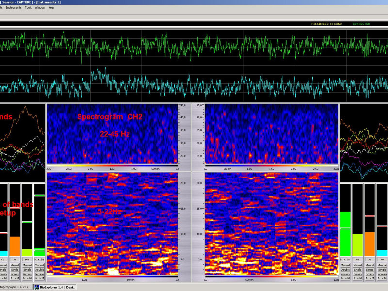 bioex1.jpg bioex1.jpg